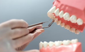 How to Fix a Gummy Smile