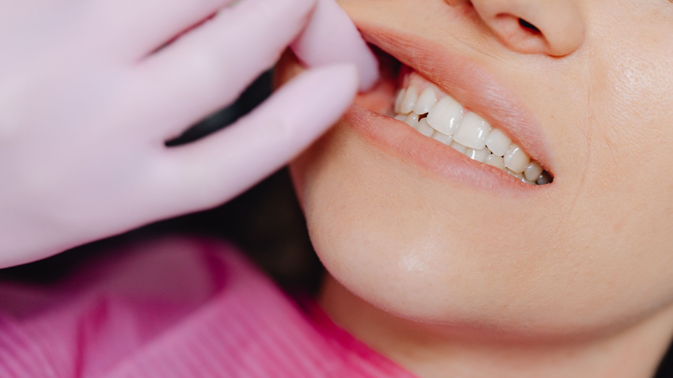 how to fix my crooked teeth