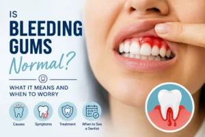 Is Bleeding Gums Normal